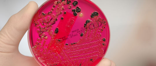Petri dish and blood agar (Credit: John Goodman, Royal College of Pathologists)