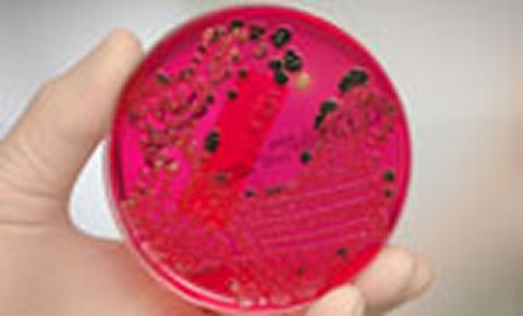 Petri dish with blood agar (Credit: John Goodman, Royal College of Pathologists)